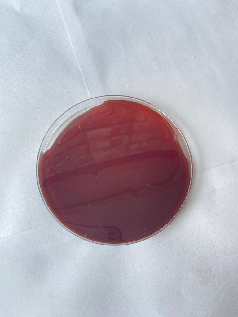 Gluten Free Malt Extract Liquid (GFL)